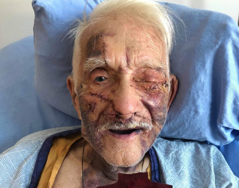 Machete attack victim’s long road to recovery